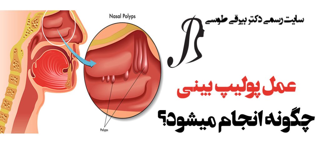 گرانترین و بهترین دکتر عمل / جراحی بینی در تهران